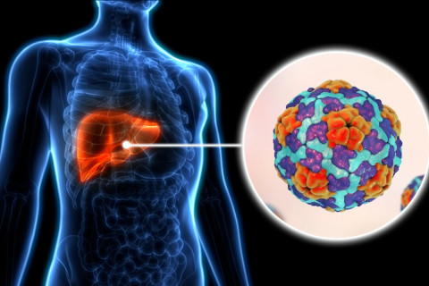 Případy hepatitidy A dosáhly nejvyšší úrovně od roku 1984